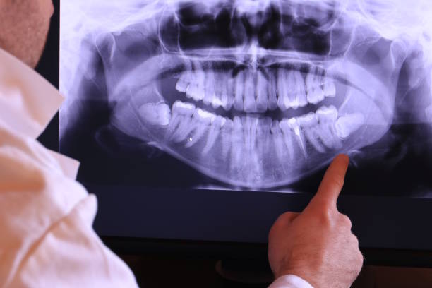 Best Chipped Tooth Repair Near Me  in Freeland, WA