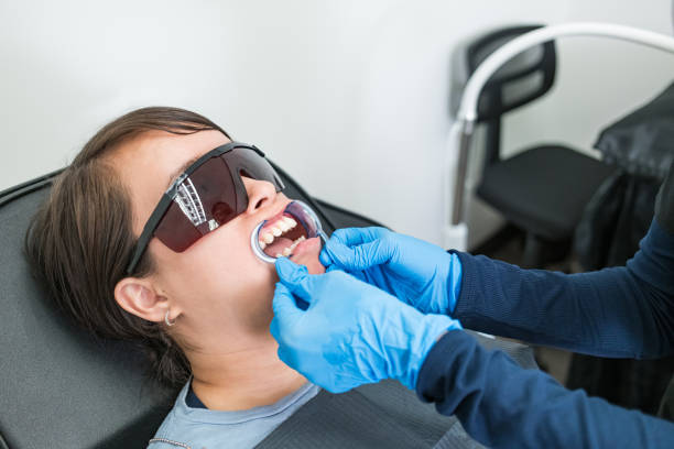 Best Teeth Whitening  in Freeland, WA